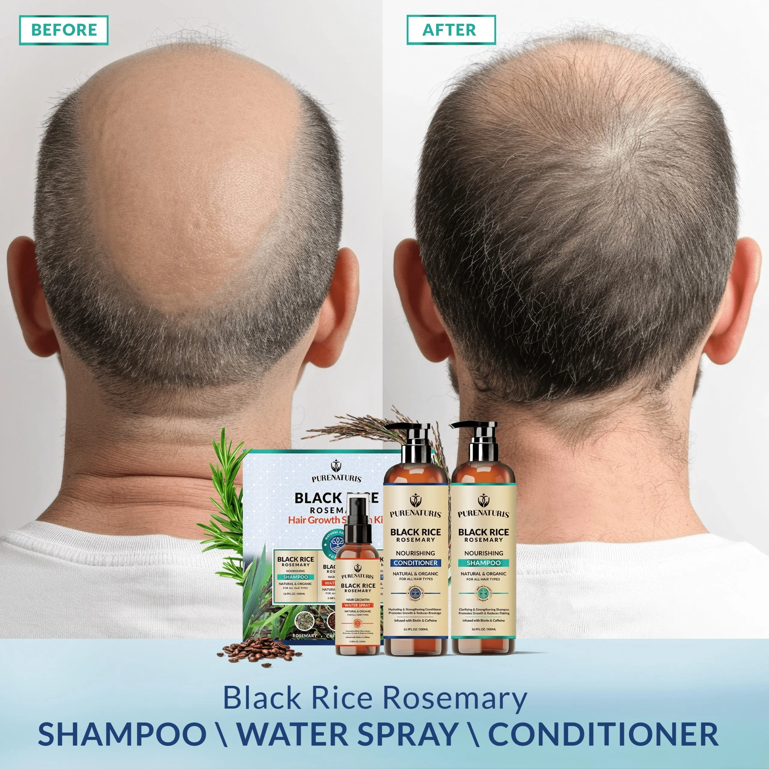 Rosemary Black Rice Water Hair Growth System Kit - Shampoo, Conditioner and Leave-in Serum